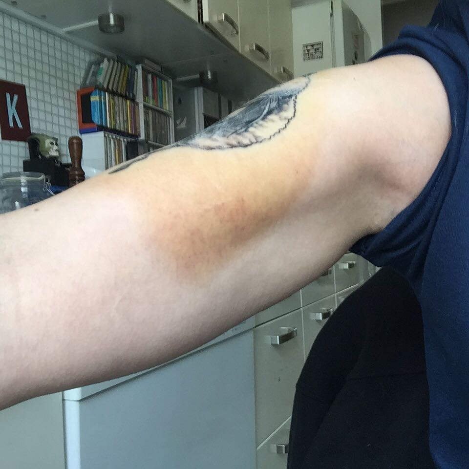 I got a tattoo of two dice on my arm but cruel trolls slam it and say it  looks like a bruise