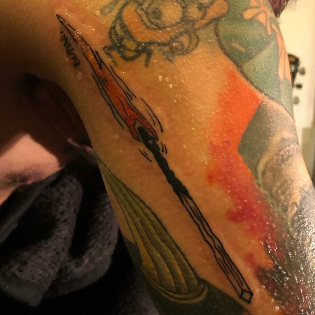 Tattoo Burn 