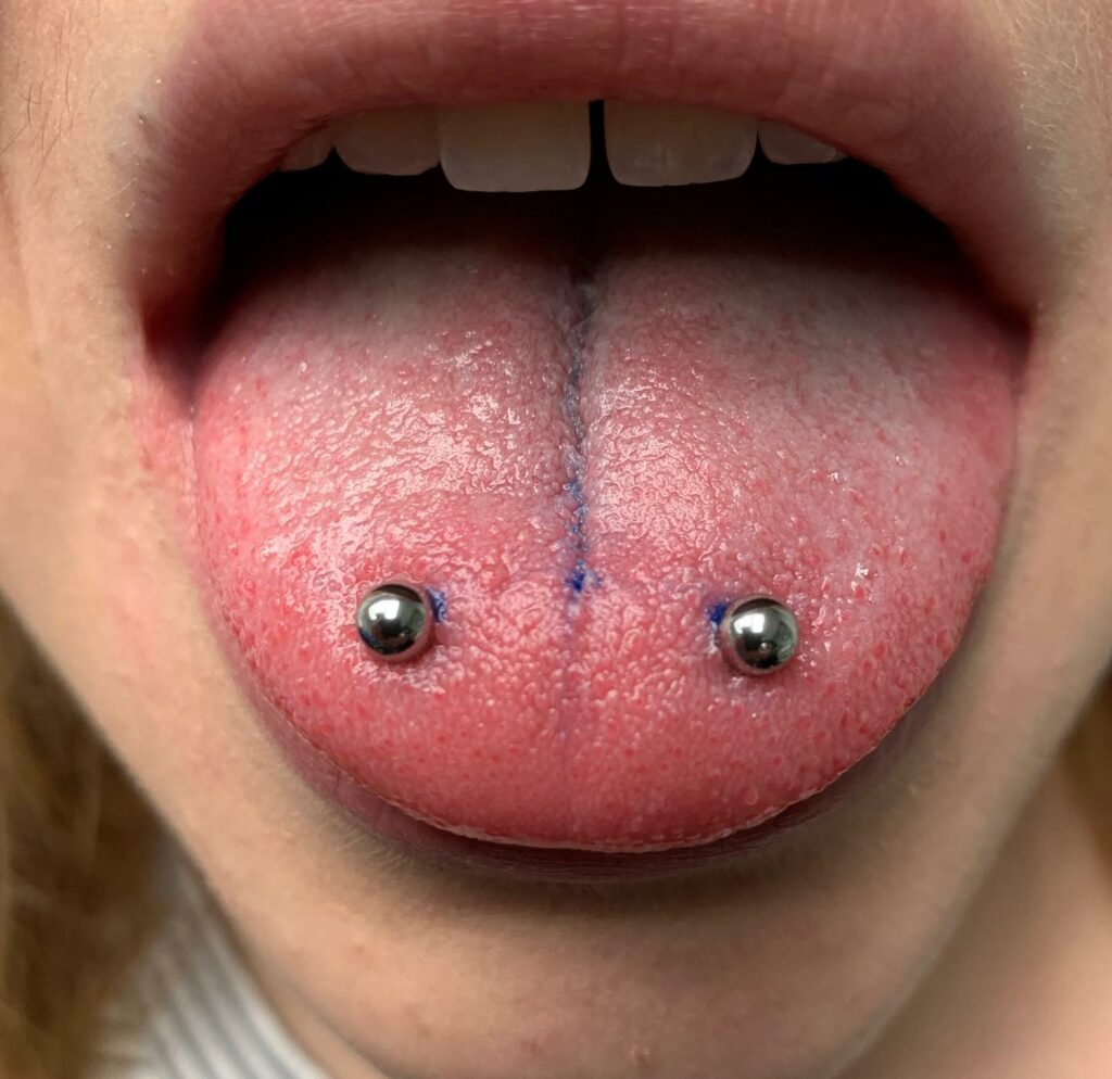 Tongue on sale ring healing