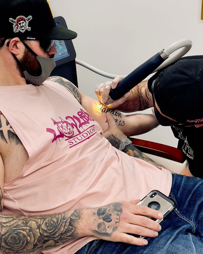 How Does Laser Tattoo Removal Work  EradiTatt