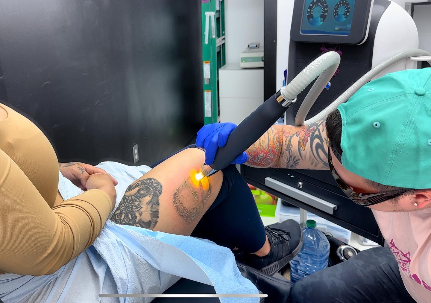 Gold Coast Tattoo Removal - Leading Picoway Laser Tattoo Removing  Specialists // Eraze Laser Clinic -- ______ Laser tattoo removal gold coast  Near Me // Eraze Laser Clinic -- ______ Best Tattoo