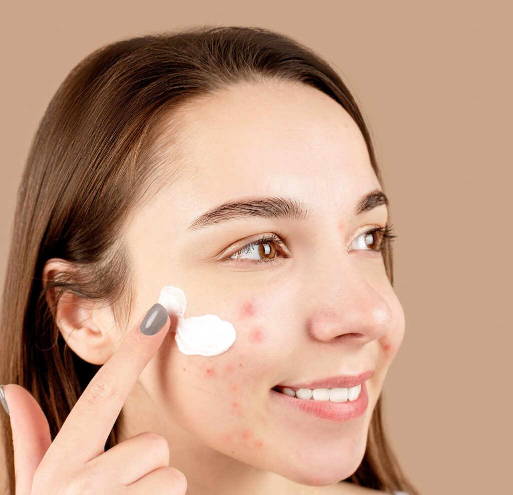 CeraVe for Acne-Prone Skin