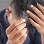 Native Shampoo Cause Hair Loss