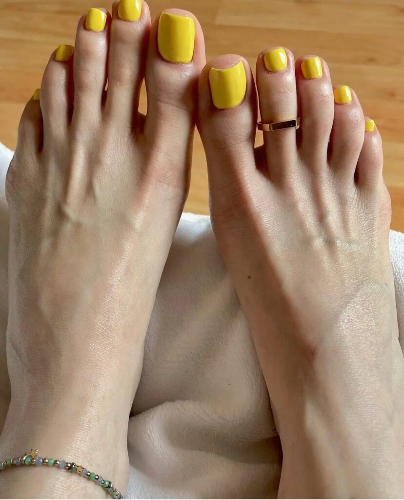 Yellow Toe Nails